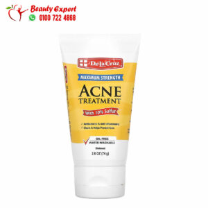 De la cruz sulphur ointment clears and helps prevent acne